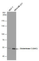 Glutaminase C (GAC) antibody [GT1075]
