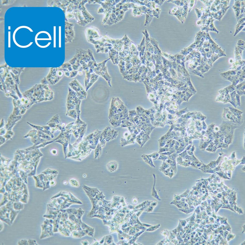 NCI-H295R 人肾上腺皮质腺癌细胞/STR鉴定/镜像绮点（Cellverse）