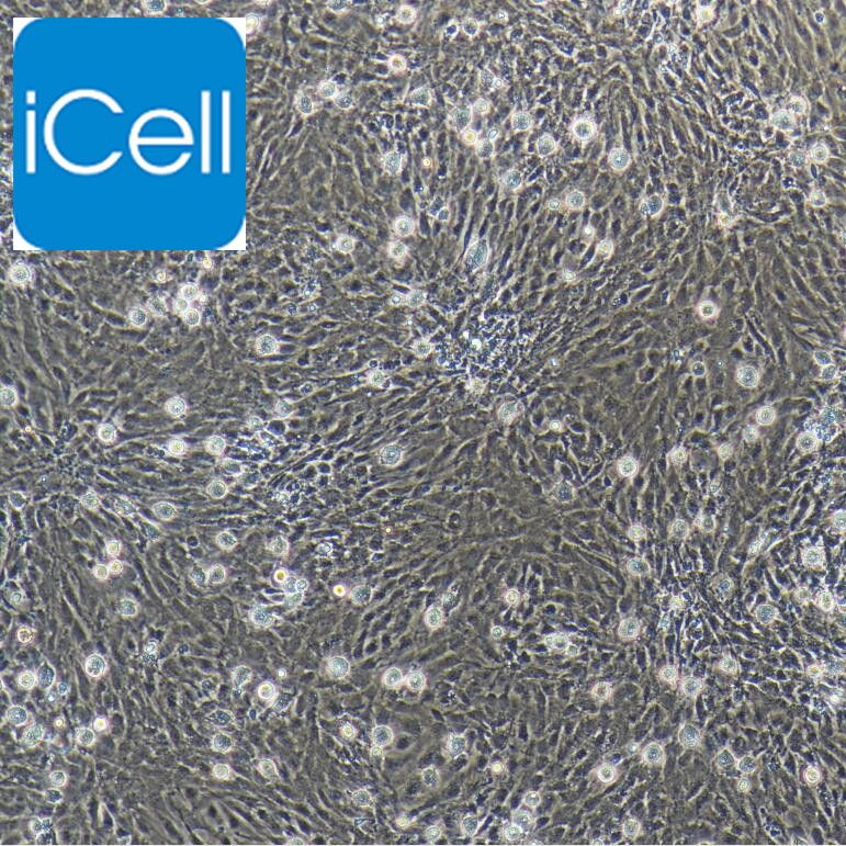 肺微血管内皮细胞/免疫荧光鉴定/镜像绮点（Cellverse）