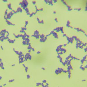 产黄纤维单胞菌