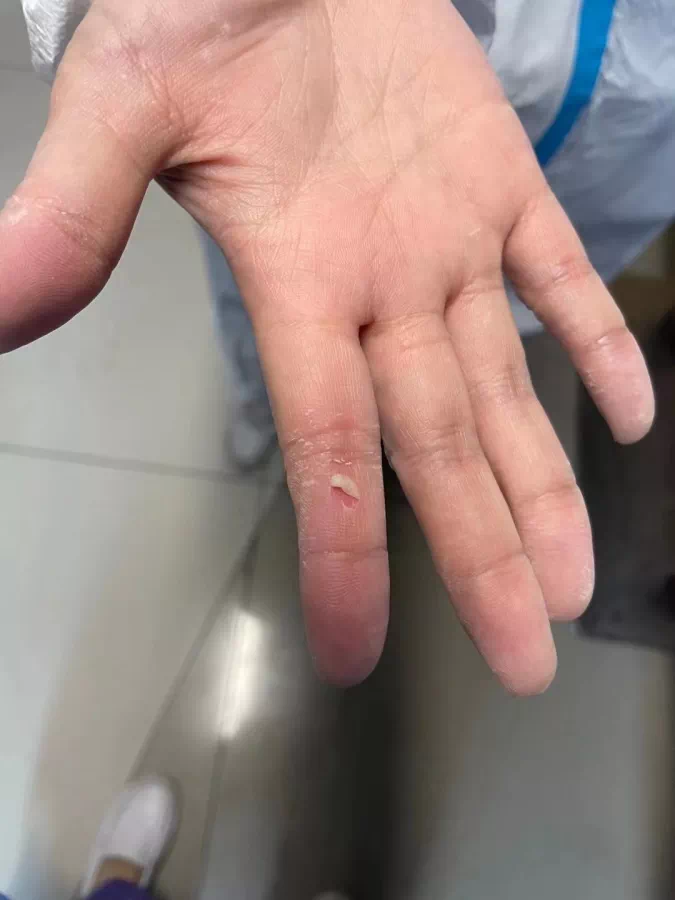 上海市同仁医院：核酸检测十二时辰