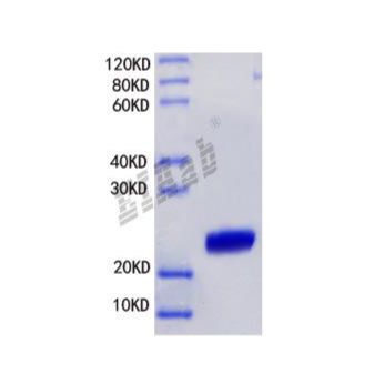 重组大鼠Hmgb1蛋白