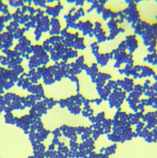 甲型溶血性链球菌