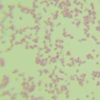 费氏中华根瘤菌