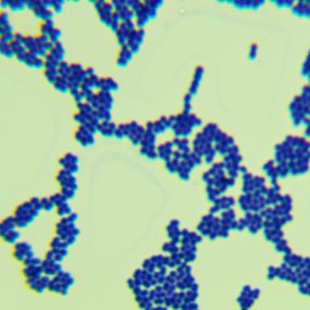 紫色色杆菌