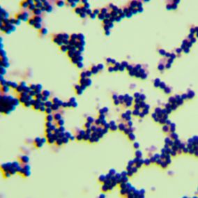 黄团孢链霉菌