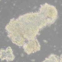 AtT20小鼠垂体瘤细胞(带STR鉴定)