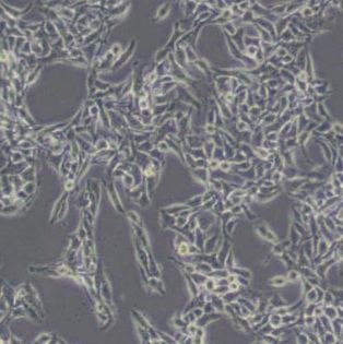 B16小鼠黑色素瘤细胞(带STR鉴定)