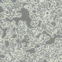 N2a小鼠脑神经瘤细胞(带STR鉴定)