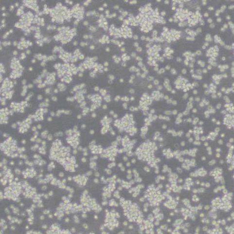 YAC1小鼠淋巴瘤细胞(带STR鉴定)