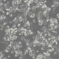 RM1小鼠前列腺癌细胞(带STR鉴定)