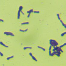 谷氨酸棒杆菌Ⅴ型