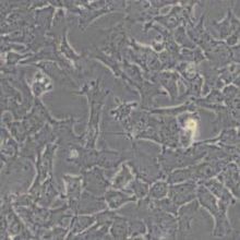 Hepa16小鼠肝癌细胞(带STR鉴定)