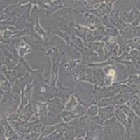 Hepa16小鼠肝癌细胞(带STR鉴定)