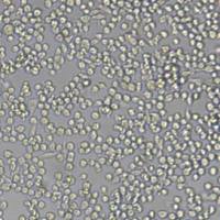 P815小鼠肥大细胞瘤细胞(带STR鉴定)