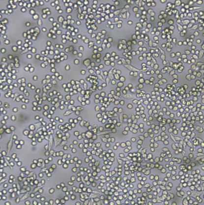 L6565小鼠白血病克隆细胞系(带STR鉴定)