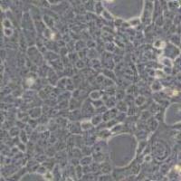 4T1小鼠乳腺癌细胞(带STR鉴定)