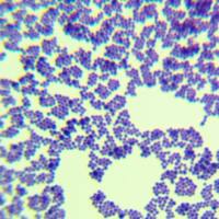 胞外多聚物鞘氨醇单胞菌