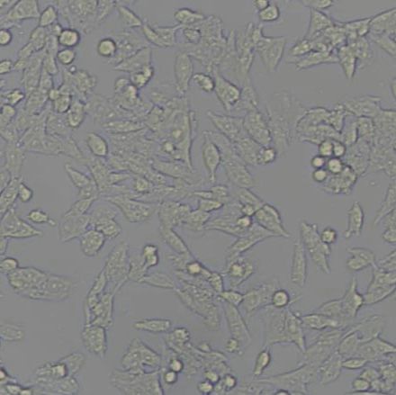 Y1小鼠肾上腺皮质瘤细胞(带STR鉴定)