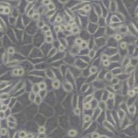 L929小鼠成纤维细胞(带STR鉴定)