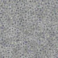 EL4小鼠淋巴瘤细胞(带STR鉴定)