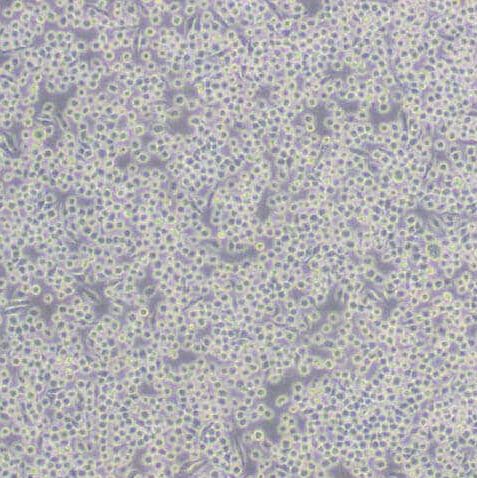 J774A.1小鼠单核巨噬细胞(带STR鉴定)
