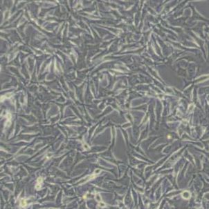 B16F10小鼠皮肤黑色素瘤细胞(带STR鉴定)