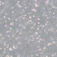 SV40 MES 13小鼠肾小球系膜细胞(带STR鉴定)