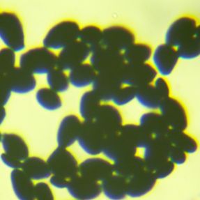 白假丝酵母定量菌株