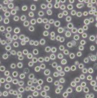 H22小鼠肝癌细胞(带STR鉴定)