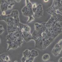 Beta-TC6小鼠胰岛素瘤胰岛β细胞(带STR鉴定)