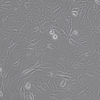 MC3T3-E1 Subclone 14 小鼠颅顶前骨细胞亚克隆14(带STR鉴定)