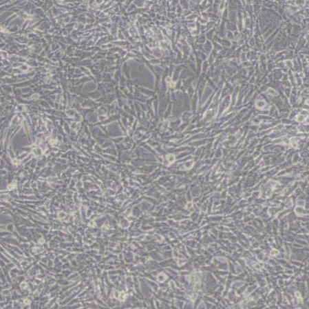 TM4正常小鼠睾丸Sertoli细胞(带STR鉴定)