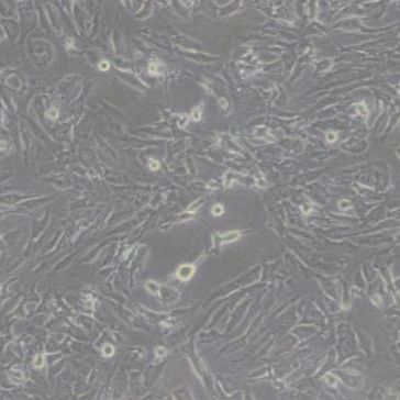 BALB/3T3 clone A31小鼠胚胎成纤维细胞(带STR鉴定)