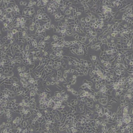 CHO/dhFr-[CHO-DXB11]仓鼠卵巢细胞(二氢叶酸还原酶缺陷)（带STR鉴定）
