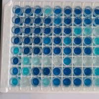 幽门螺旋杆菌抗体 幽门螺旋杆菌单抗 鼠抗幽门螺旋杆菌单克隆抗体