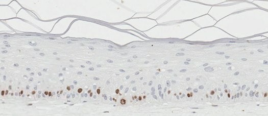 Organotypic skin models contain actively proliferating keratinocytes. (A)