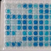 人弓形虫抗体 人弓形虫单抗 鼠抗人弓形虫单克隆抗体