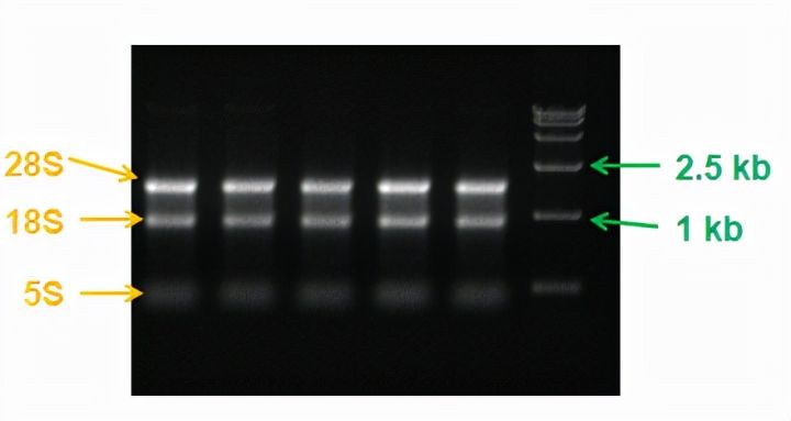 如何确认RNA的质量?