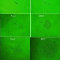 血清淀粉样蛋白A抗体 血清淀粉样蛋白A单抗 鼠抗血清淀粉样蛋白A配对单克隆抗体