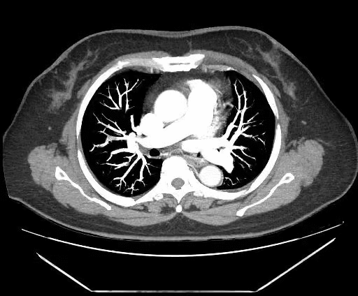 坐久了会得病?这 5 种人尤其需要小心!