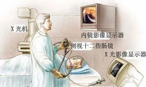 98 岁！刷新记录！重庆北部宽仁医院肝胆外科不开刀为高龄患者取胆管结石
