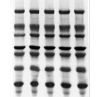 Immobilon-PSQ PVDF 膜,0.2um,26.5 cmx3.75m（热销）