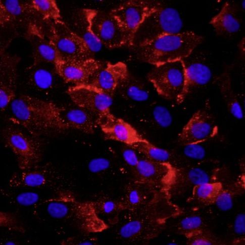 人脐静脉内皮细胞