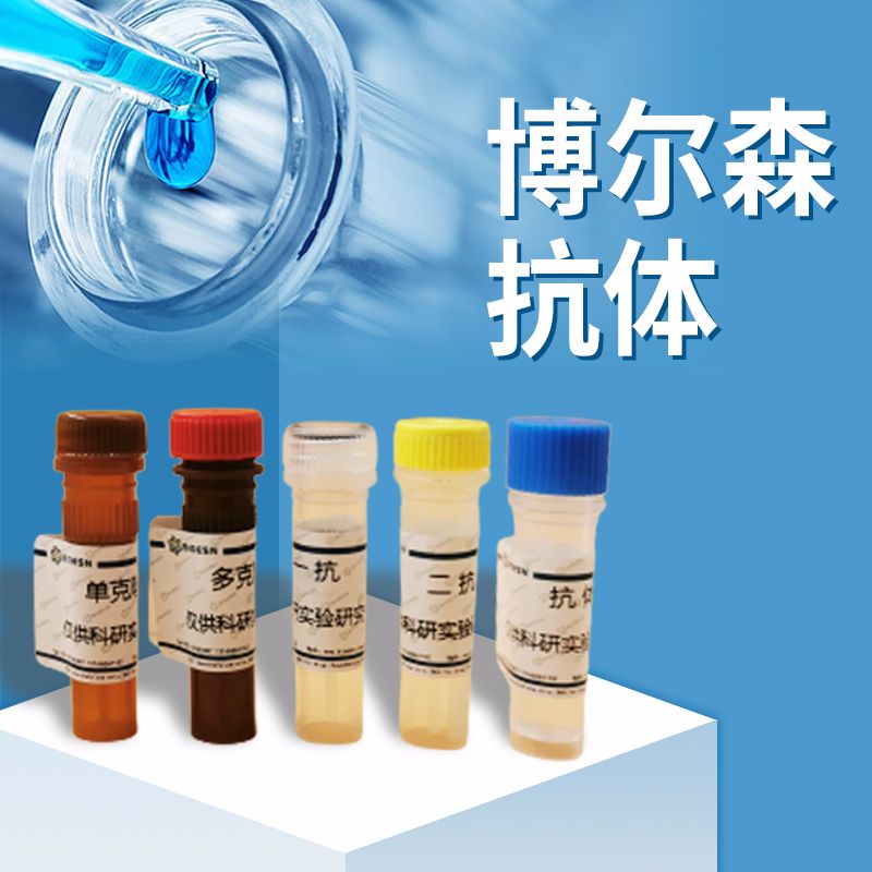 PLAU Rabbit Polyclonal Antibody