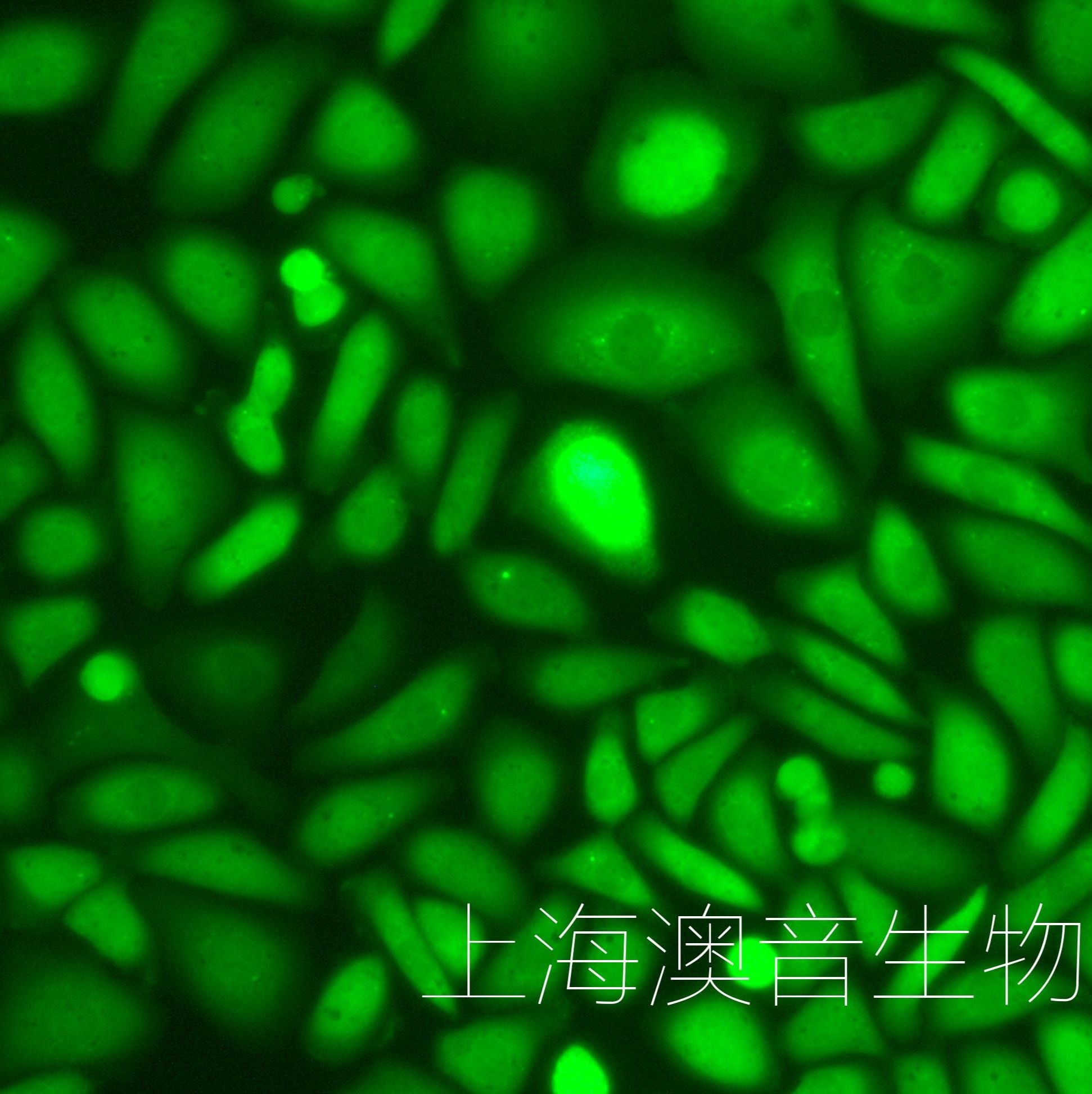 SK-OV-3-LUC-GFP-Puro[SKOV-3-LUC;SKOV-3-GFP]双标记的人卵巢癌细胞