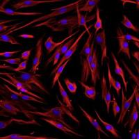 人牙周膜成纤维细胞