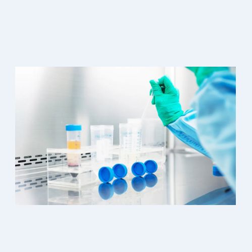 猪丹毒杆菌（SER）荧光PCR试剂盒试剂盒
