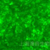 SW620-LUC-GFP-Puro[SW620-LUC;SW620-GFP]双标记的人结直肠腺癌细胞
