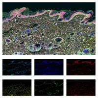 多重免疫组化mIHC